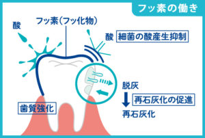 フッ素って効果あるの？安全なの？