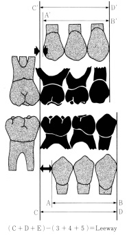 乳歯列の奥歯に隠されたスペース